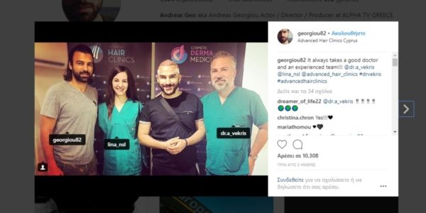Και οι διάσημοι λένε ΝΑΙ στη μεταμόσχευση μαλλιών!