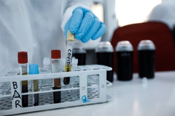 Βγήκαν τα αποτελέσματα από τις επαφές του ζευγαριού στη Γιαννιτσού