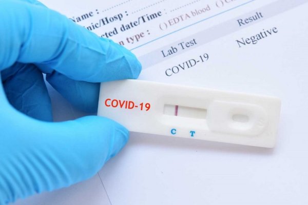 Δωρεάν Rapid Test την Πέμπτη στη Στυλίδα