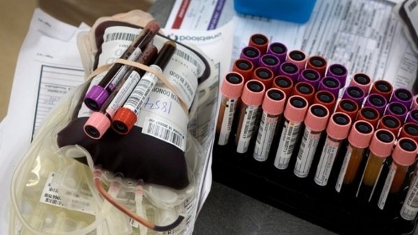 Σημαντική μείωση στη συλλογή αίματος κατά τη διάρκεια της πανδημίας