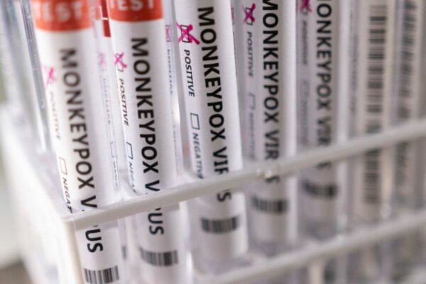 Ισπανία: Σε 84 αυξήθηκαν τα κρούσματα της ευλογιάς των πιθήκων, σύμφωνα με το υπουργείο Υγείας